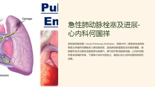 急性肺动脉栓塞及进展-心内科何国祥