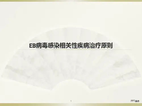 EB病毒感染相关性疾病治疗原则  ppt课件