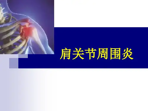 1肩周炎精品PPT课件
