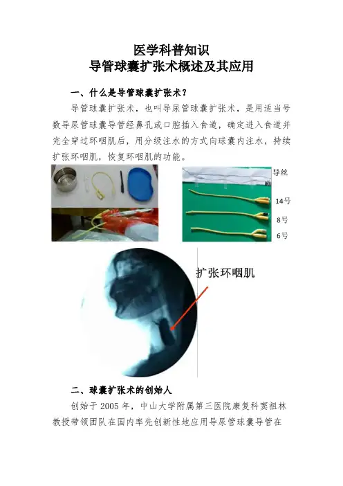 医学科普知识导管球囊扩张术概述及其应用