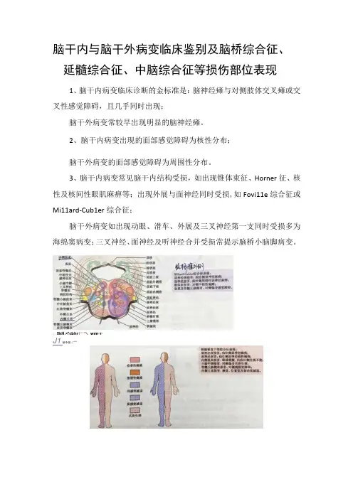 脑干内与脑干外病变临床鉴别及脑桥综合征延髓综合征中脑综合征等损伤部位表现