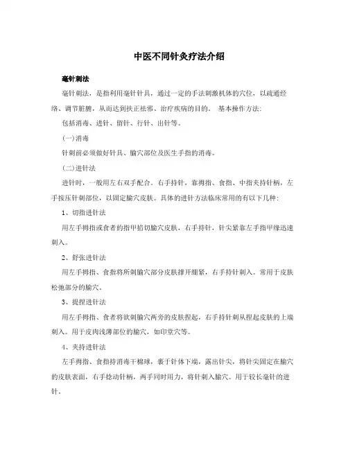 中医不同针灸疗法介绍