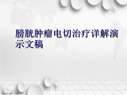 膀胱肿瘤电切治疗详解演示文稿