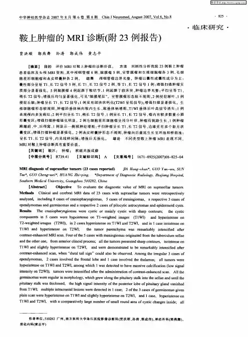 鞍上肿瘤的MRI诊断(附23例报告)
