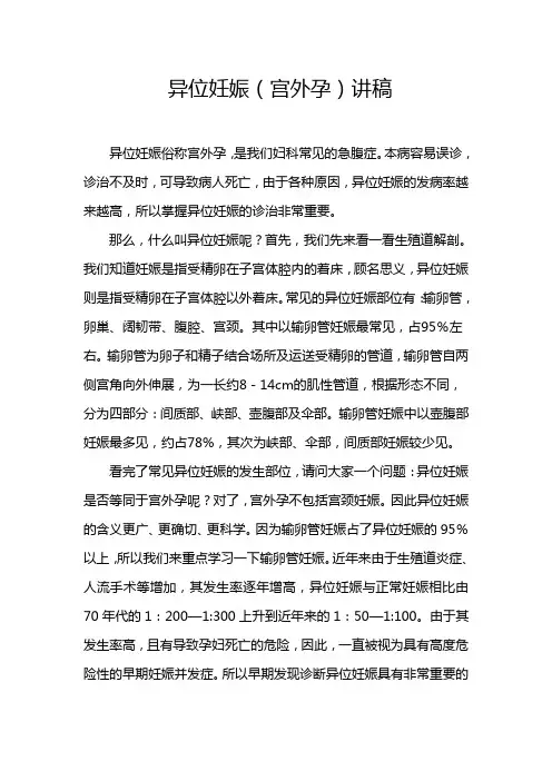 异位妊娠电视台 讲稿
