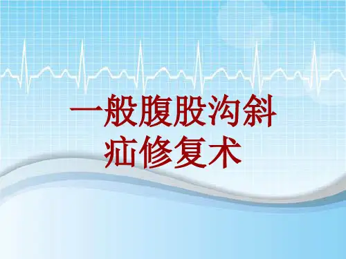 手术讲解模板：一般腹股沟斜疝修复术
