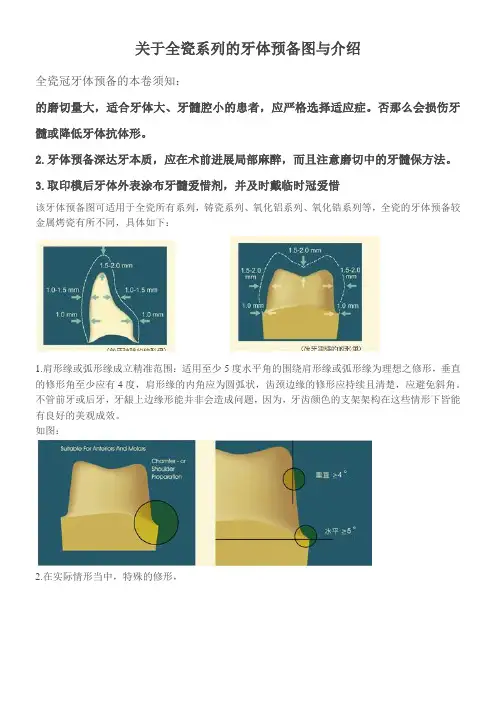 关于全瓷系列的牙体预备图与介绍