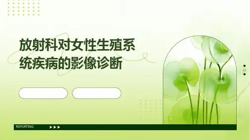 放射科对女性生殖系统疾病的影像诊断