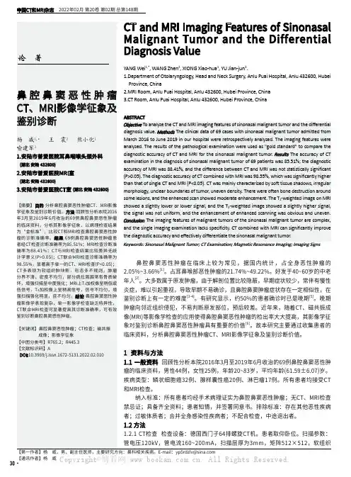 鼻腔鼻窦恶性肿瘤CT、MRI影像学征象及鉴别诊断