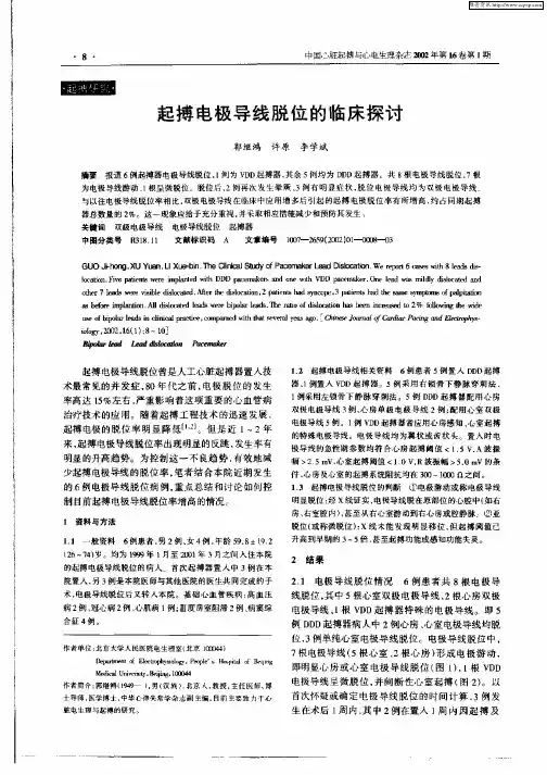 起博电极导线脱位的临床探讨