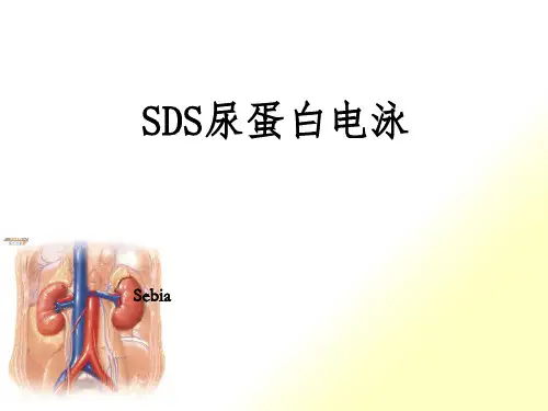 SDS尿蛋白及本周氏电泳的意义
