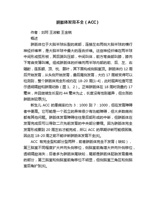 胼胝体发育不全（ACC）
