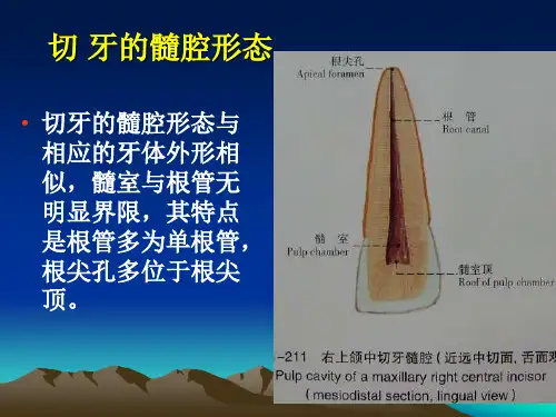 口腔解剖生理学：切牙的髓腔形态
