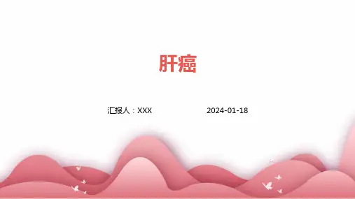 肝癌汇报ppt课件