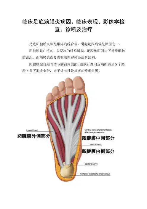 临床足底筋膜炎病因、临床表现、影像学检查、诊断及治疗