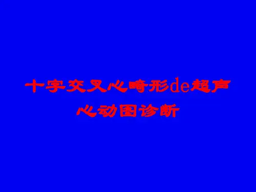 十字交叉心畸形的超声心动图诊断培训课件