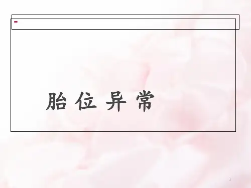 胎位异常  ppt课件