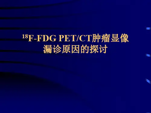 18F-FDG PETCT肿瘤显像漏诊原因的探讨