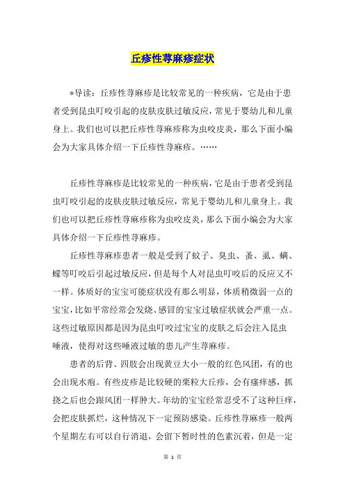 丘疹性荨麻疹症状1