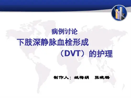 病例讨论 深静脉血栓