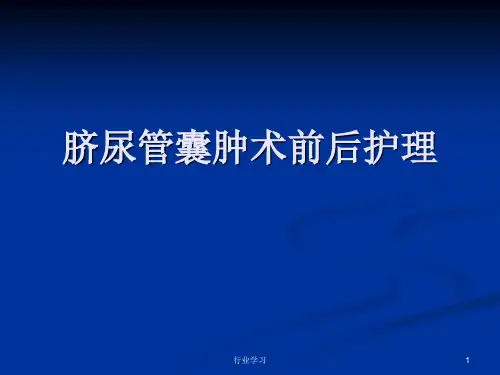 脐尿管囊肿术后护理[知识浅析]