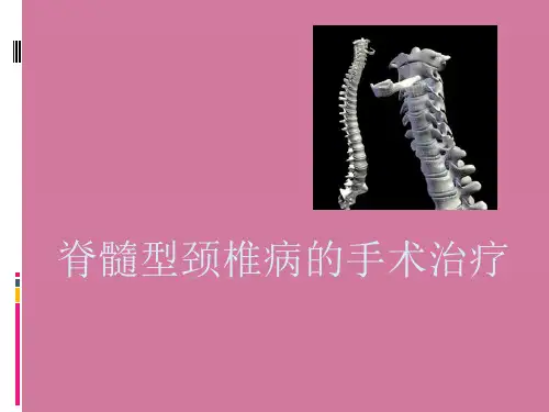 颈椎病的手术治疗ppt课件