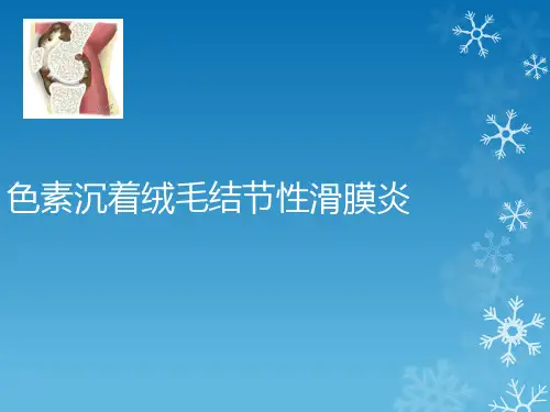 色素沉着绒毛结节性滑膜炎