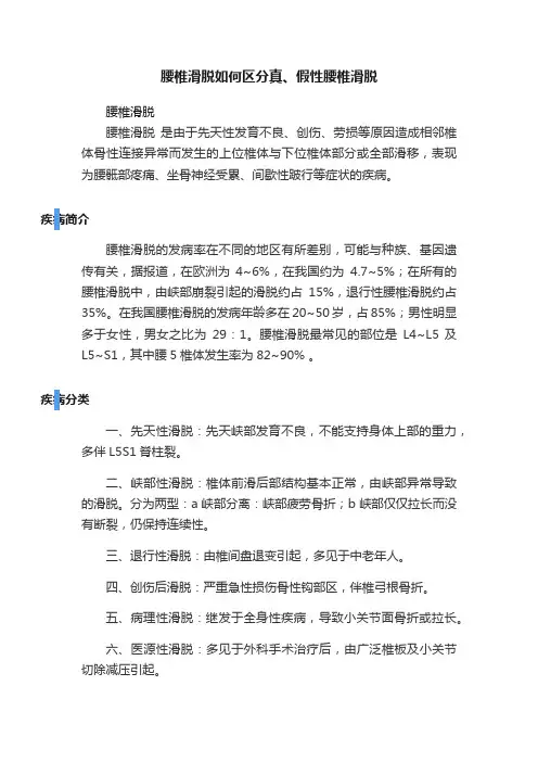 腰椎滑脱如何区分真、假性腰椎滑脱