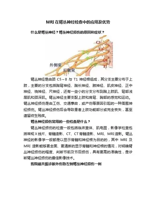 MRI在臂丛神经检查中的应用及优势