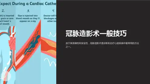 冠脉造影术一般技巧
