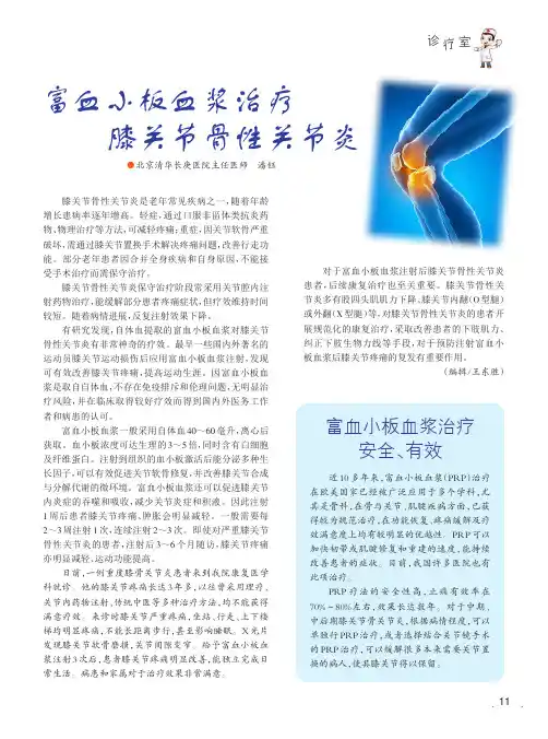 富血小板血浆治疗膝关节骨性关节炎
