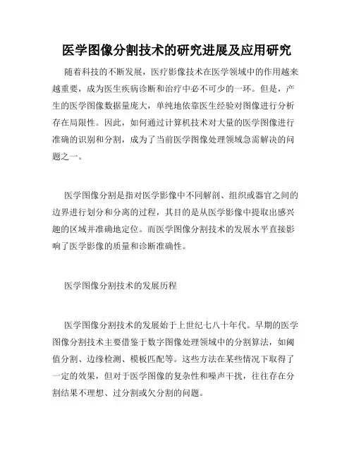 医学图像分割技术的研究进展及应用研究