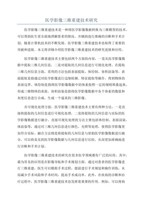 医学影像三维重建技术研究
