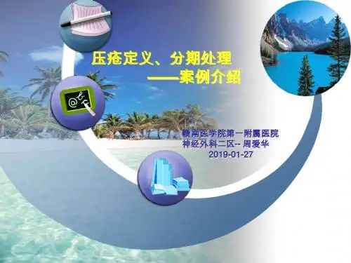 压疮之概念案例介绍-PPT精品文档