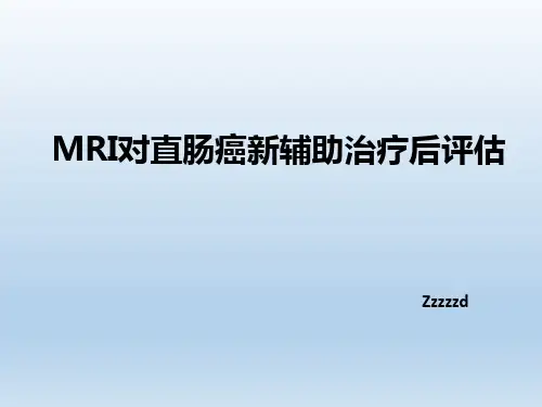 直肠癌新辅助治疗后评估