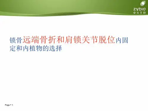 锁骨远端骨折