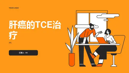 肝癌的TACE治疗