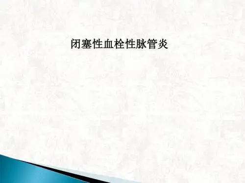 闭塞性血栓性脉管炎PPT课件