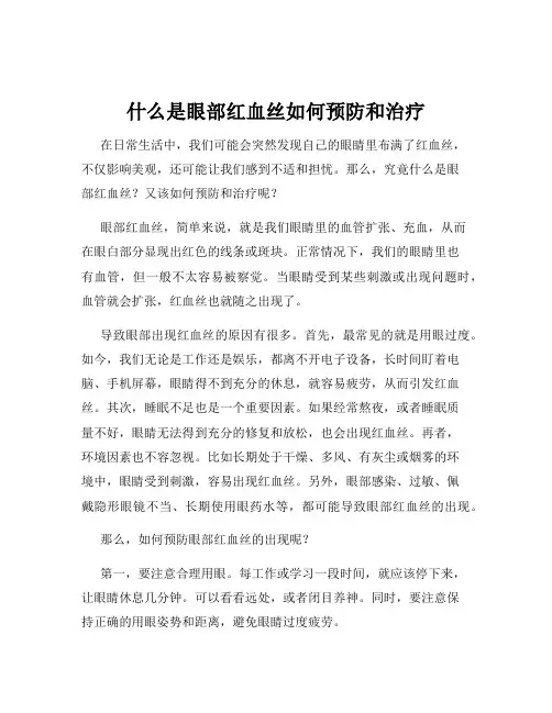 什么是眼部红血丝如何预防和治疗
