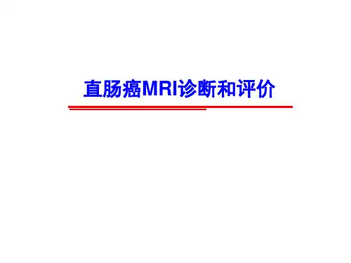 直肠癌MRI诊断和评价