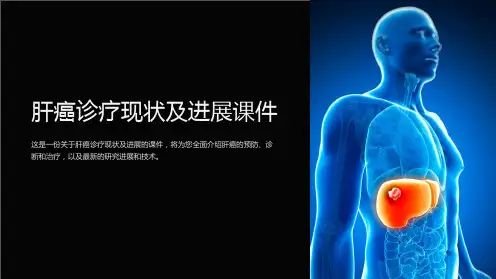 肝癌诊疗现状及进展课件