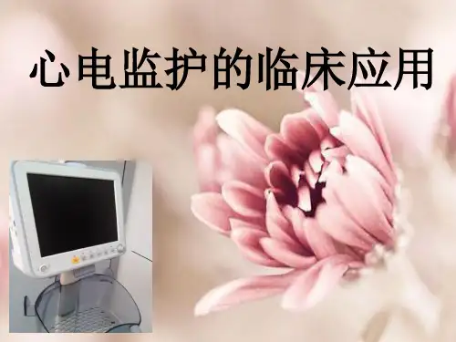 心电监护的临床应用PPT课件
