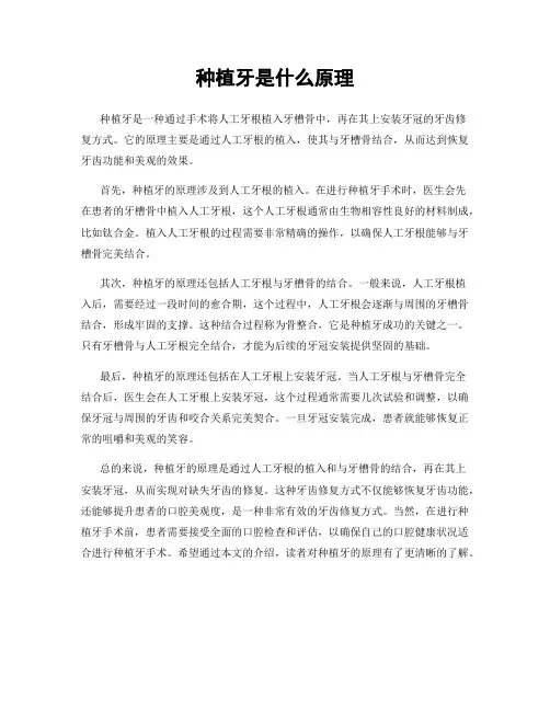 种植牙是什么原理