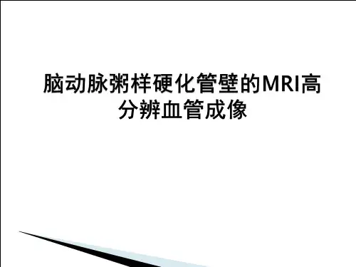血管高分辨成像