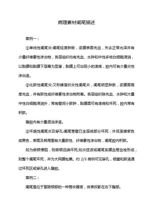 病理素材阑尾描述