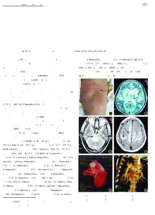 以中枢神经系统损害为主要临床表现的干燥综合征一例