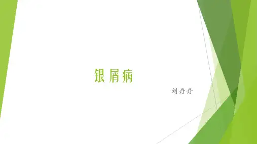 银屑病