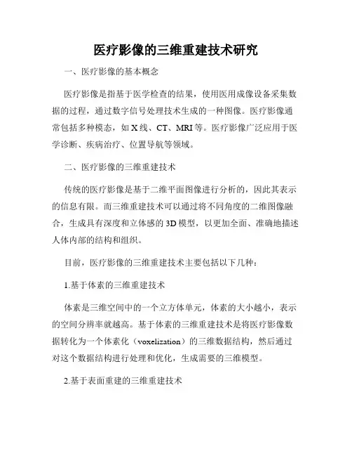 医疗影像的三维重建技术研究