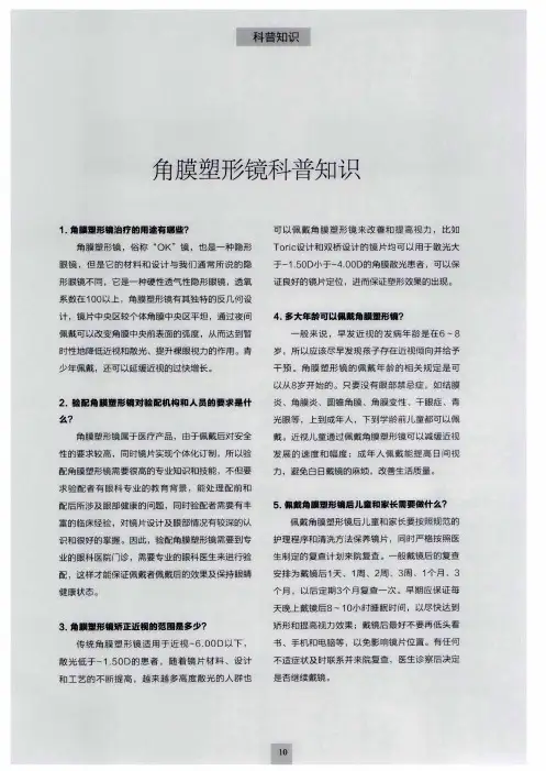 角膜塑形镜科普知识