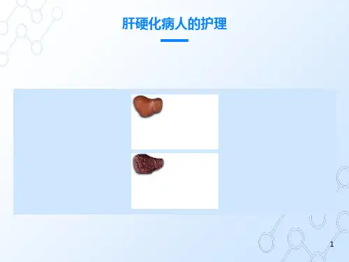 内科护理学-肝硬化病人的护理